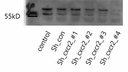 CXCL5의 수용체인 CXCR2 knock down 세포주 제작