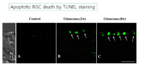 저자들의 연구 사진 : 녹내장 모델에서 망막신경절세포의 apoptosis를 TUNEL staining에서 확인