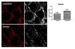 사상판을 이루는 주요 세포외기질엔 탄력섬유 (elastin, 붉은색)을 염색한 사진으로 한국인과 서양인 간에 탄력섬유의 양적인 차이를 발견하였다