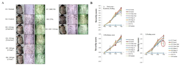 After application, mice were exposed to UV-LEDs(310 and 340 nm), NB-UVB, or UVA irradiation every other day. (b) Mice were divided into nine groups: G1, Normal; G2, Control (IMQ-applied only); G3, 310 nm -20 mJ/cm2 G4, 310 nm -50 mJ/cm2 G5, 340 nm- 1 J/cm2 G6, 340 nm- 2 J/cm2 G7, NB-UVB; and G8, UVA, G9, Combination 310 nm - 20 mJ/cm2 + + 340 nm - 1 J/cm2