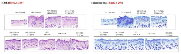 Histological examination of lesions in NC/Nga mice with Df-induced AD-like skin lesions irradiated with 310 nm and 340 nm UV-LEDs. Dorsal skin specimens from mice irradiated with UV-LEDs (310 and 340 nm), NB-UVB, or UVA three times a week were collected at day 35. Dorsal skin specimens were stained with (a) H&E, or (b and c) toluidine blue for counts