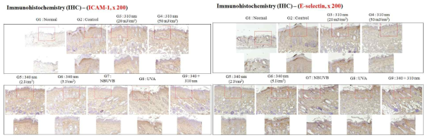 Anti-inflammatory effects of 310 nm and 340 nm UV-LED irradiation of Df-induced AD-like skin lesions in NC/Nga mice. Paraffin sections of dorsal skin biopsies from G1, normal; G2, control (Df-sensitized only); G3, 310 nm; G4, 340 nm; G5, 340 nm plus 310 nm; G6, NB-UVB; and G7, UVA groups were immunohistochemically (IHC) stained for: (a) ICAM-1, (b) E-selectin, and (c) IL-31. Dark brown dots indicate positively stained cells (n = 3 dorsal skin images per group). The IHC intensity score represents the average of the scores in each IHC staining intensity category (++ indicates pronounced findings, +moderate findings and 0 no/scant findings) identified in each core. Original magnification×200