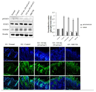 최근 UV 광 치료에 대한 논문을 토대로 STAT3 조절에 대한 확인을 진행하였으며, 310 nm (UVB 영역 대)와 340 nm (UVA 영역 대)의 동시 조사의 병용효과가 있는지 단백질 수준을 확인함
