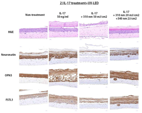 인공피부의 표피층을 분화하여 건선과 유사한 조직 양상을 보여주는 결과에는 IL-17을 50 ng/ml 처치하는 것이 적당하다고 판단되었으며, 이를 토대로 IL-17을 72시간 유도 후 310 nm 50 mJ/cm2, 310 nm 20 mJ/cm2과 340 nm 2 J/cm2의 각 조건을 인공 피부에 조사하여 변화를 확인함. 두꺼워진 표피층이 UV-LED에 의해 정상화 되는 것을 확인함