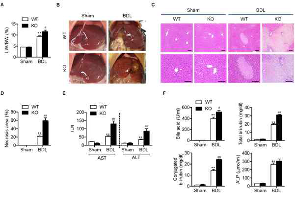 Aggravation of BDL-induced liver injury by Sirt6 deficiency. (A, B) Liver weight/body weight and photographs of representative mouse liver were obtained 10 days after BDL (n=4-8). (C, D) Liver necrosis was assessed by H #, p<0.05 and ##, p<0.01 versus WT BDL