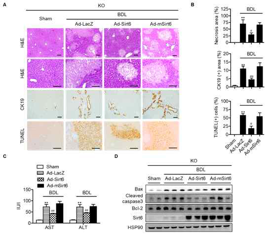 Attenuation of liver injury by re-expression of Sirt6 in BDL KO mice. Sirt6 KO mice were injected intravenously with 1 × 109 pfu of either Ad-LacZ, Ad-Sirt6, or Ad-mSirt6 and then subjected to BDL for 10 days. (A) Representative microscopic pictures of liver sections. Bars =200 μm. (B) Necrosis (H #, p<0.05 and ##, p<0.01 versus Ad-LacZ BDL