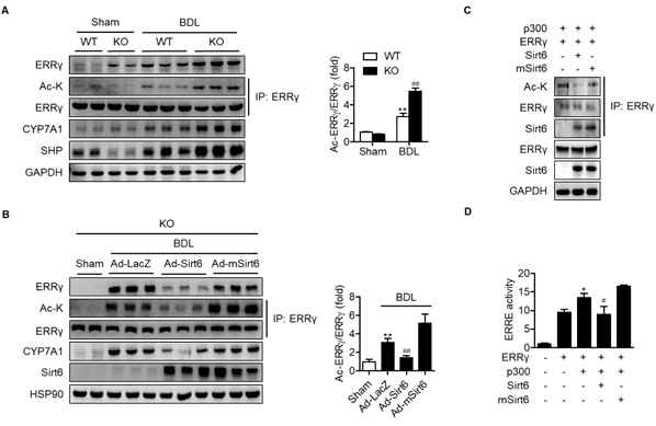 Deacetylation of ERRγ by Sirt6. (A) Protein levels of total- and acetylated-ERRγ, CYP7A1, and SHP in WT and KO livers were examined by western blotting (n=6). (B) Sirt6 KO mice were injected intravenously with 1 × 109 pfu of either Ad-LacZ, Ad-Sirt6, or Ad-mSirt6 and then subjected to BDL. Acetylation of ERRγ was determined (n=6). (C) After transfection of HEK293T cells, acetylation of ERRγ was determined. (D) ERRE-luciferase activity was determined (n=5). Values are mean ± SEM. *, p<0.05 and **, p<0.01 versus sham-WT, Ad-LacZ or ERRγ; ##, p<0.01 versus BDL-WT or ERRγ+p300