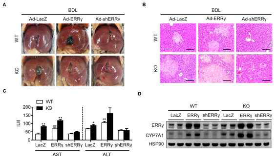 Ad-shERRγ abolishes the detrimental effects of Sirt6 deficiency. (A-C) WT and Sirt6 KO mice were injected intravenously with Ad-LacZ, Ad-ERRγ, or Ad-shERRγ, followed by BDL. Gross morphology of the liver, necrosis, and levels of AST and ALT (n=4-6) were analyzed. Bars =200 μm. (D) Western blot analysis for ERRγ and CYP7A1. Values are mean ± SEM. *, p<0.05 and **, p<0.01 versus WT; ##, p<0.01 versus Ad-LacZ