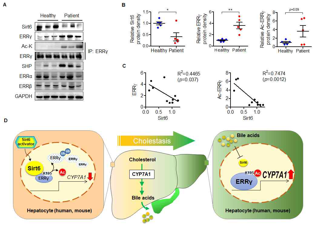 Increase in acetylated ERRγ in patients with cholestasis. (A) Expression of Sirt6 and total- and acetylated-ERRγ were compared in liver tissues from healthy subjects and patients with cholestasis. (B) Band intensities were quantified by densitometry (n=5-9). (C) The coefficient of determination was used to evaluate the association between Sirt6 expression and that of either totalor acetylated-ERRγ (n=13). (D) Proposed summary