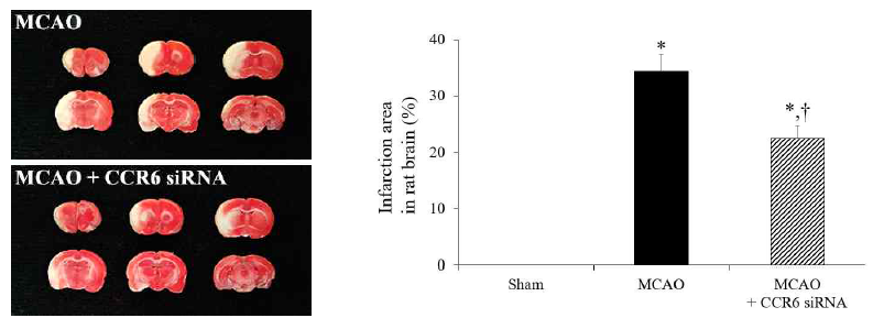 뇌허혈 유발 24시간 후 MCAO 단독수술군과 MCAO+CCR6 siRNA 투여군에서의 뇌경색 영역