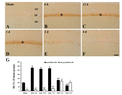 전뇌허혈 유발 후 해마 CA1 영역에서의 CCR6 immunohistochemistry 결과