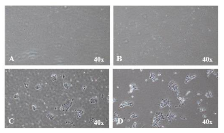 멤브레인 코팅 재질에 따른 생착 및 분화 연구 - A: Collagen type IV (human placenta Sigma C5533) - B: Collagen type I, rat tail (Corning Life Science, Cat. No. 354236) - C: Vitronectin (rhVTN-N) (A14700, Life Technologies) - D: Matrigel (BD Biosciences, Bedford, MA, 356231)