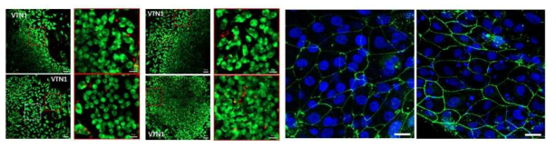 Vitronectin coating 후 분화 4일 후 Live  bar: 20 μm)