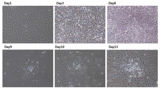 CytoTune™ iPS 2.0 Sendai Reprogramming을 통한 역분화 줄기세포 배양(40x)