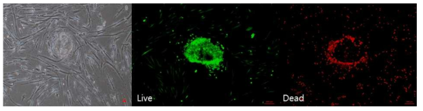 역분화 줄기세포 배양(Day 29) 광학현미경 소견 (좌, 40x) 및 면역 염색법을 통한 생존 평가 (우, 50x) (passage 4)