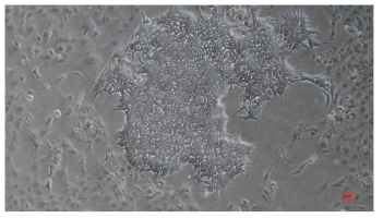 TrypLE treat을 통한 역분화 줄기세포 clony 형성 (40x)(passage 4)