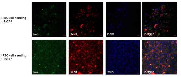 면역 염색법을 통한 칩 탑재 후 세포 수에 따른 역분화 줄기세포 생존 평가 (200x)