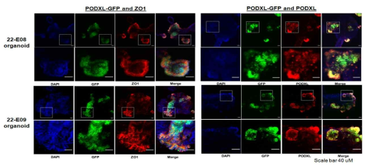 PODXL-GFP knock in 콩팥 오가노이드