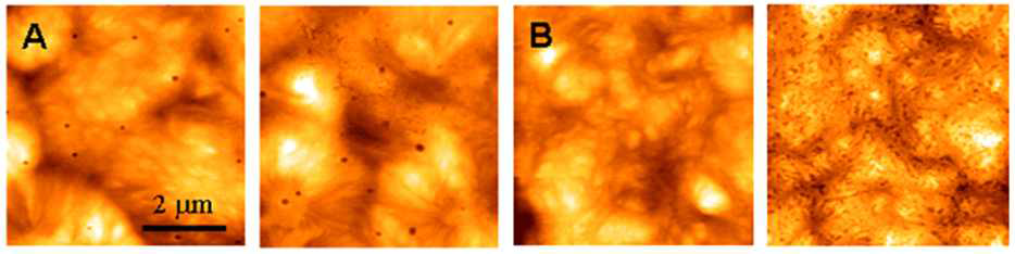 AFM topographic images of as-cast F8-PLLA (A) and PDMS-b-PLLA (B) films. Their right images are after 120 min of enzymatic degradation at 37 °C