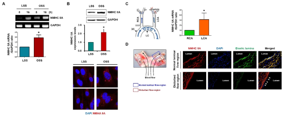 혈류전단응력 변화 조건하에서 NMHC IIA의 발현 변화