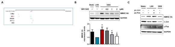 기능이상 혈관내피세포 표적 단백질 NMHC IIA의 발현에 대한 전사인자 AP-1의 영향