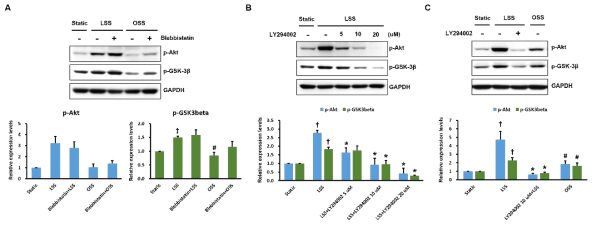 표적 단백질 NMHC IIA의 혈류전단응력 변화에 의한 GSK-3β의 인산화에 대한 영향