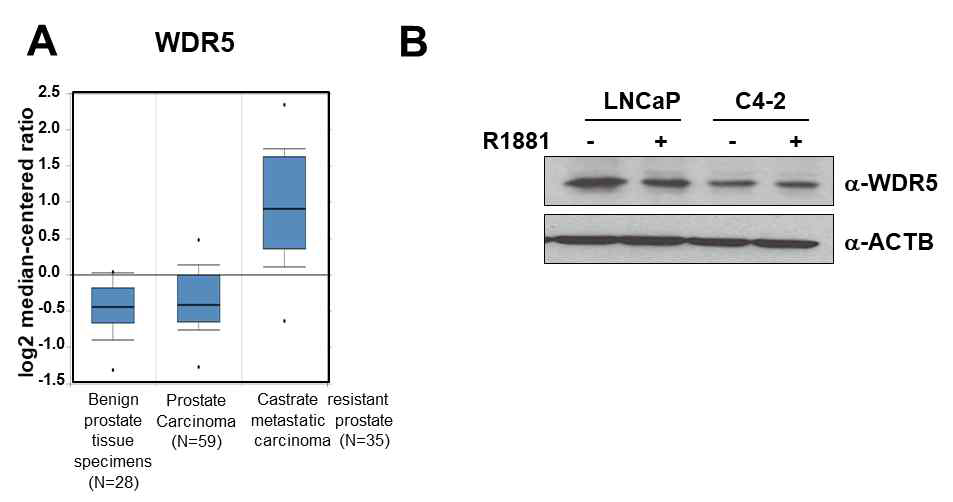 CRPC에서의 WDR5 발현 확인