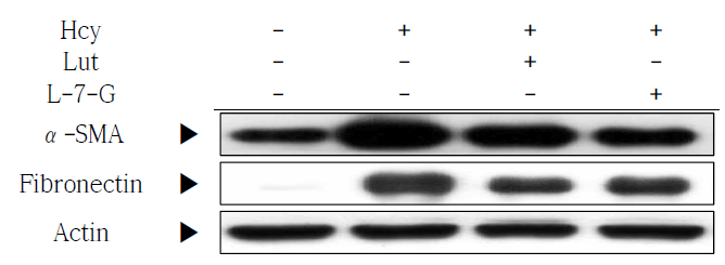 Effect of luteolin and luteolin-7-O-glycoside on α-SMA and fibronectin in aorta in homocysteine fed C57BL/6J mice. Hcy, Homocysteine; Lut, Luteolin; L-7-G, Luteolin-7-O-glycoside; α-SMA, α-smooth muscle actin