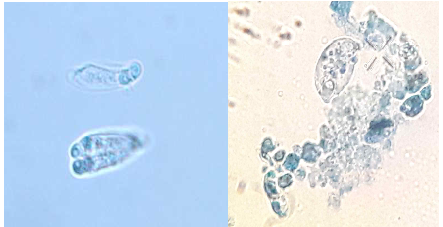 여윔증 넙치에서 분리한 P. anisocaudata(left)와 E, leei(right)