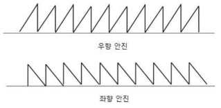 안진에 따른 파형 특징