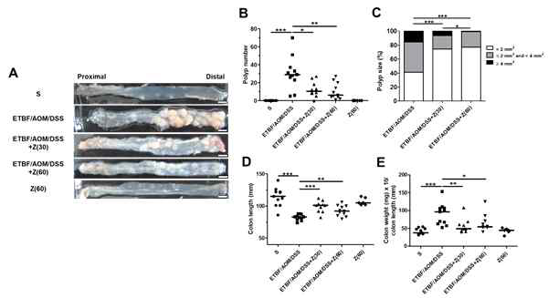 Zerumbone inhibits ETBF-mediated tumorigenesis. AOM-treated BALB/c mice were infected with WT-ETBF (bft-2) and subjected to two cycles of DSS (1%) for 9 weeks. During two DSS cycles, BALB/c mice were given zerumbone (30, 60 mg/kg, p.o., three times a week). A. Representative gross macroscopic image of the colon. B. Polyp number. C. Polyp size distribution. D. Colon length (mm), E. Colon weight (mg)/colon length (mm) ratio. Polyp number, polyp size distribution, colon length, and colon weight/colon length ratio were measured on the last day of ETBF/AOM/DSS-treated experiments. S, sham control; Z, Zerumbone. Each dot represents one mouse. Scatter plot. Horizontal bar, median. *P < 0.05, **P < 0.01, ***P < 0.001. ns, no statistical significance