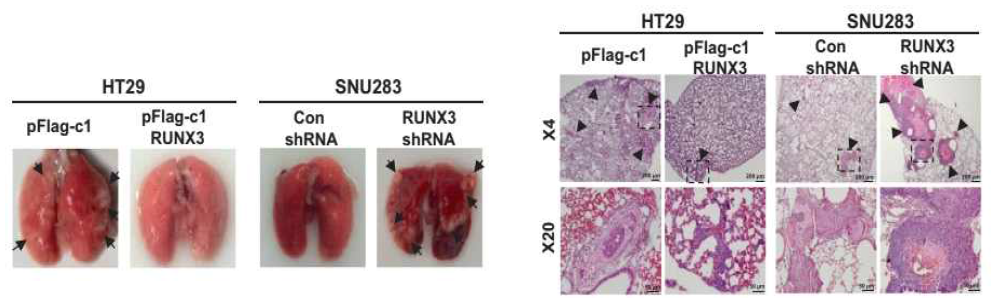 RUNX3에 의한 암전이 억제 효과
