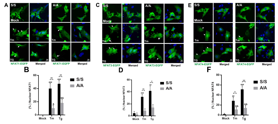 A와 B) S/S와 A/A 세포주에 Tm 또는 Tg 처리 후, 과발현된 NFAT1-EGFP의 핵이동을 GFP 형광을 이용하여 관찰한 이미지와 NFAT1 단백질의 핵이동 수치화 그래프 그림. C와 D) S/S와 A/A 세포주에 Tm 또는 Tg 처리 후, 과발현된 NFAT3-EGFP의 핵이동을 GFP 형광을 이용하여 관찰한 이미지와 NFAT3 단백질의 핵이동 수치화 그래프 그림. E와 F) S/S와 A/A 세포주에 Tm 또는 Tg 처리 후, 과발현된 NFAT4-EGFP의 핵이동을 GFP 형광을 이용하여 관찰한 이미지와 NFAT4 단백질의 핵이동 수치화 그래프