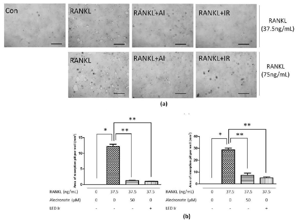 Effect of LED irradiation on bone resorption in RANKL-induced BMMs. a Photomicrographs of the bone resorption activity of osteoclasts (×100 magnification). Space bar, 20 μm. b Pit areas were quantified by using ImageJ software; *p < 0.05 compared to the control; **p < 0.05, compared to RANKL-stimulated cells. Irirradiation, Al alendronate