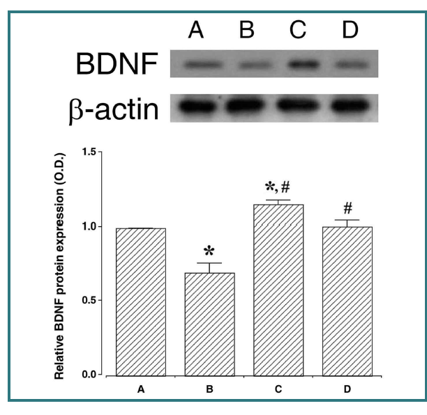 POCD유발에 따른 해마 내 BDNF 발현 변화에 PDRN이 미치는 영향. (A) 대조군, (B) POCD 유발군, (C) POCD 유발 후 PDRN 투여군, (D) POCD 유발 후 PDRN+DMPX. *represents P < 0.05 compared to control group. #represents P < 0.05 compared to the POCD-induced group