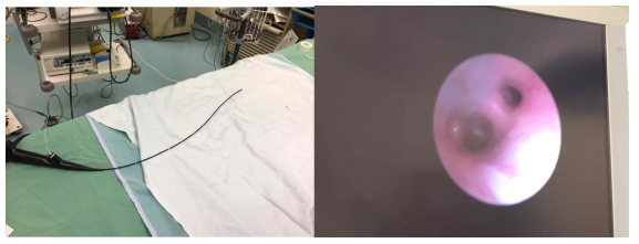 Ultrathin bronchoscope의 외형과 inside view of rabbit bronchus