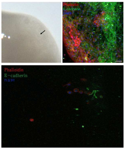 Bright field and Confocal images of LTO culture in day 50. Immunofluorescence staining with LTO for F-actin (red), E-cadherin (green), and DAPI (blue). Black arrow of bright field image indicates that portion of the image and video taken with confocal. The video shows the three-dimentional structure of the black arrow. Scale bar: 50μm