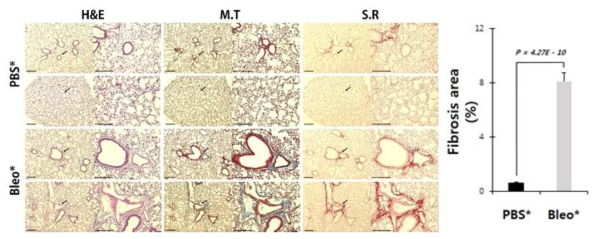 Histological identification of Bleomycin-induced pulmonary fibrosis in vivo. (Left) Lung section staining with Hematoxylin & Eosin, Masson’s Trichrome, and Sirius Red. The right panel in each group is an enlarged picture of the arrows. These sections were obtained from WT mice intraperitoneally administrated with PBS or Bleomycin for 6 weeks (Marked with *). Scale bar: 200 μm. (Right) Quantification of fibrosis areas with Masson trichrome staining. Percentage of fibrotic areas (blue color) were calculated as the ratio fibrotic areas to the total area in 10-20 randomly selected high-power fields (200X) on each slide. Data are represented as mean ± SEM