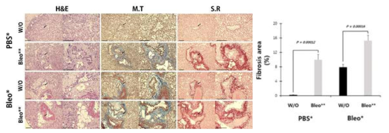 Histological identification of Bleomycin-induced pulmonary fibrosis in vitro. (Left) Lung tissue 3D organoid culture staining with Hematoxylin & Eosin, Masson’s Trichrome, and Sirius Red. The right panel in each group is an enlarged picture of the arrows. These sections were obtained from 3D organoid samples cultured for 2 weeks after intraperitoneally administrated to WT mice with PBS or Bleomycin for 6 weeks. PBS* and Bleo* are intraperitoneally administered PBS or Bleomycin for 6 weeks (Marked with *). W/O groups are no extra treatment in vitro. Bleo** are Bleomycin-treated groups in 3D organoid culture for 2 weeks (Marked with **). Scale bar: 100 μm. (Right) Quantification of fibrosis areas with Masson trichrome staining. Percentage of fibrotic areas (blue color) were calculated as the ratio fibrotic areas to the total area in 10-20 randomly selected high-power fields (400X) on each slide. Data are represented as mean ± SEM