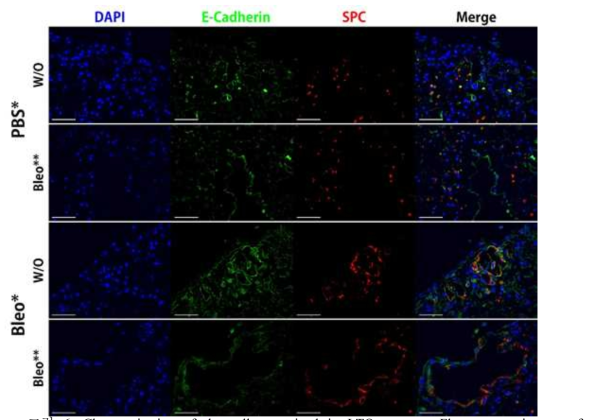 Characterization of the cells contained in LTO systems. Fluorescence images of LTO culture in day 14. (A) Immunofluorescence staining with LTO for E-cadherin (green), SPC (red), and DAPI (blue). Scale bar: 50μm