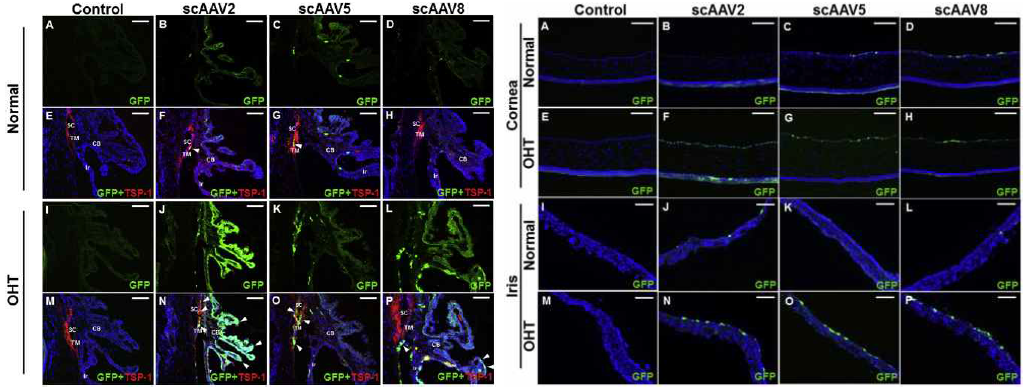 고안압 녹내장 쥐 및 정상 대조군 쥐의 전안부 조직에서 scAAV transduction 양상 (참고문헌 5)