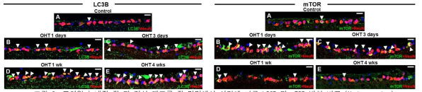 고안압 녹내장 쥐 및 정상 대조군 쥐 망막에서 시간에 따른 LC3B 및 mTOR 발현 비교 (Under review)
