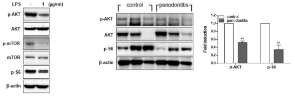치주환자 및 치은섬유아세포에서 증가된 자가포식이 AKT 신호기전에 의해 유발 됨을 확인함