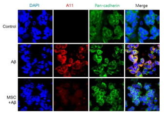 Immunostaining for internalized oligomeric Aβ