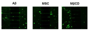 MSCs inhibit transmission of Aβ through lipid raft-mediated endocytosis