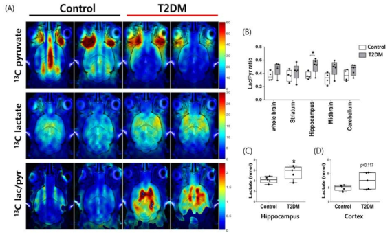 제2당뇨병 (T2DM) 동물의 뇌에서 초분극 13C pyruvate chemical shift 영상획득 (A). 뇌 영역에 따른 Lactate/Pyruvate ratio 도출 (C) 해마 (hippocampus)와 (D) 피질 (cortex)에서의 lactate 양 측정