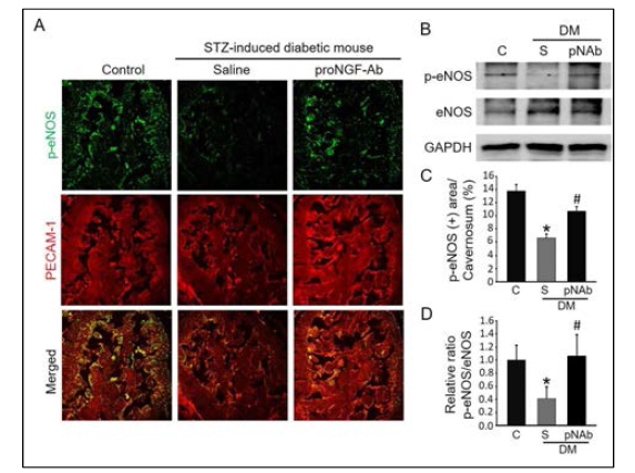 항-ProNGF 항체는 당뇨 마우스 음경조직의 음경해면체 내에서 eNOS의 인산화를 유도함