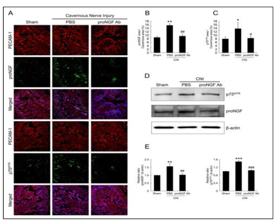 항-proNGF 항체는 신경손상 마우스에서 proNGF 및 p75NTR 발현을 억제시킴