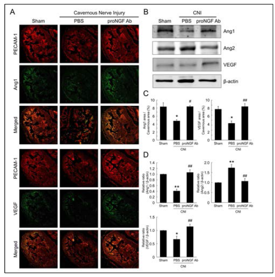 항-ProNGF 항체는 음경조직 내에서 혈관생성인자의 발현을 촉진함