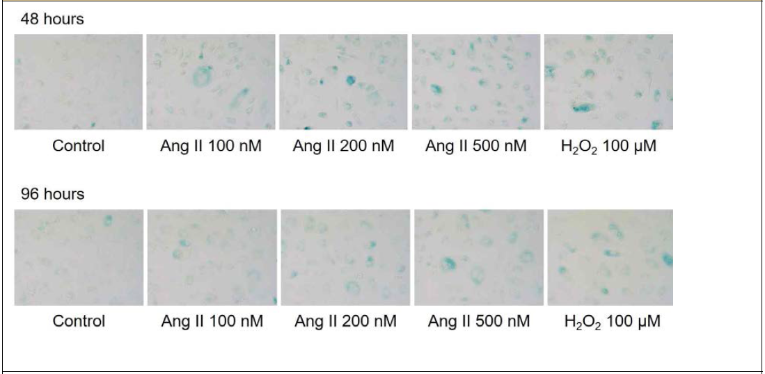 Angiotensin II 및 H2O2에 의한 48, 96시간째 노화 유도